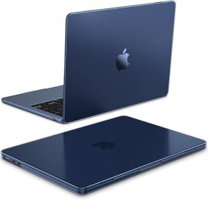 Macbook M1 Pro 13 Inch Screen